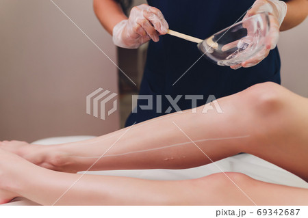 Beautician Giving Epilation Laser Treatment To Woman On Thigh. Beautician Giving Epilation Laser Treatment To Woman On Thigh. 69342687