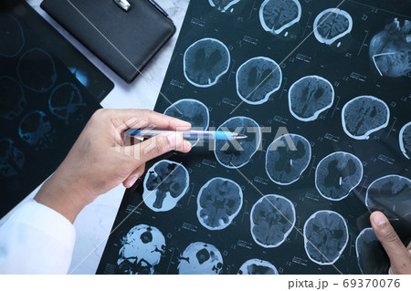 Male doctor hold i analyzing xray photography closeup 69370076