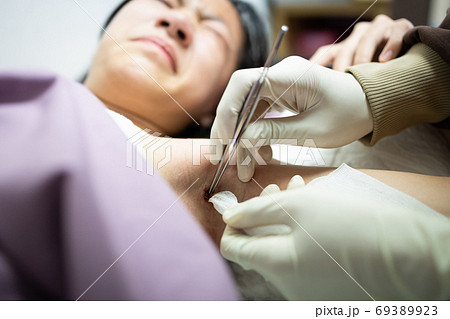 Cleaning the wound on the armpit,woman nurse with medical gloves using a gauze cloth with tincture,betadine stuffed into the wound reduce risk of infection after surgery,hygienic wound cleaning 69389923
