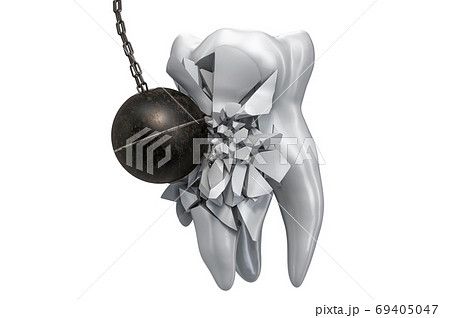 Tooth destroying by wrecking ball. Tooth Pain concept. 3D render Tooth destroying by wrecking ball. Tooth Pain concept. 3D render 69405047