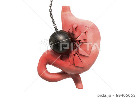 Human stomach destroying by wrecking ball. Pain in stomach, stom 69405055