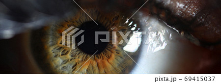 Laser correction vision concept 69415037
