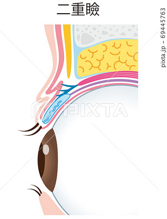 二重瞼の構造　まぶた　断面図 69445763