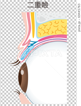 二重瞼の構造　まぶた　断面図 69445763