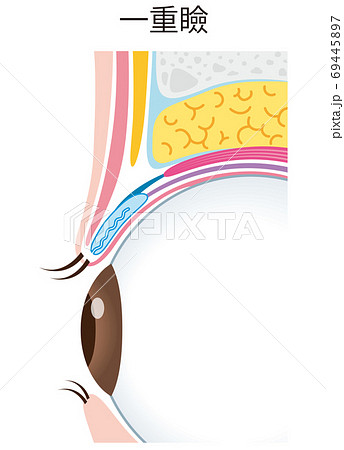 一重瞼の構造　まぶた　断面図 69445897