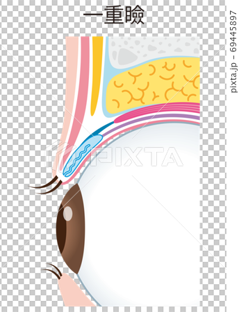 一重瞼の構造　まぶた　断面図 69445897