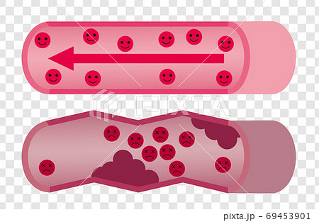血管 キャラクター 69453901