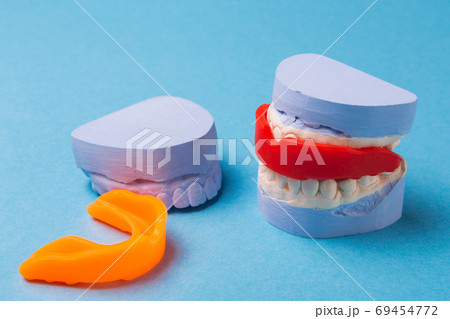 concept of dentistry and tooth protection, on a blue background several casts of the human jaw and two mouth guards, close-up 69454772