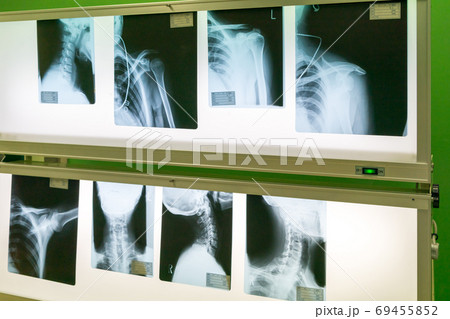 Hospital Hospital 69455852
