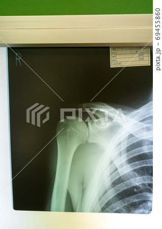 Hospital Hospital 69455860