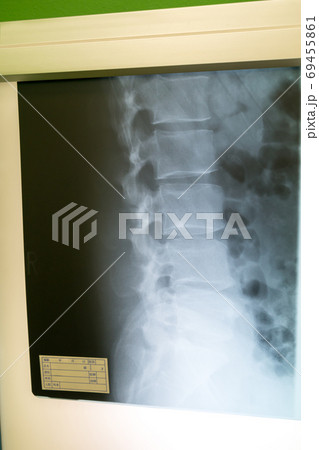 Hospital 69455861