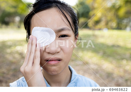 Asian teenage girl cover with blindfolded bandaged eye to protect against dust after surgery from hordeolum(stye) infection or conjunctivitis,pink eye,woman feel pain,eyes injury, burning,swelling  69463622