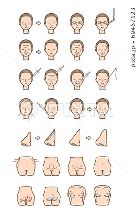 美容整形セット　シミ皺たるみ他 69467123