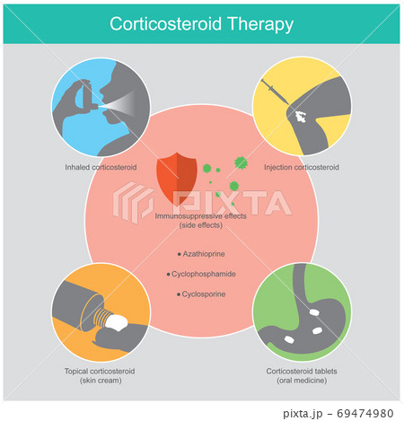Corticosteroid Therapy. Illustration explain the therapy inflamm Corticosteroid Therapy. Illustration explain the therapy inflamm 69474980