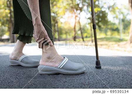 Closeup of legs of senior woman feeling pain in the joints bones,ankle tendon injury,gout disease,osteoarthritis,ligament and muscle problems,elderly people touching ankle due to sprain after walk Closeup of legs of senior woman feeling pain in the joints bones,ankle tendon injury,gout disease,osteoarthritis,ligament and muscle problems,elderly people touching ankle due to sprain after walk 69530134