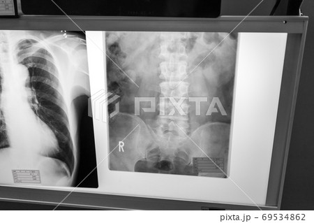 Hospital Hospital 69534862