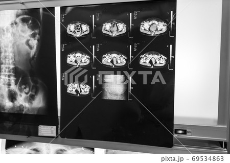 Hospital Hospital 69534863