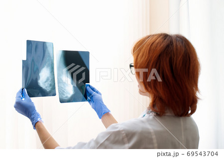 The doctor looks at the x-ray of the female mammary glands 69543704