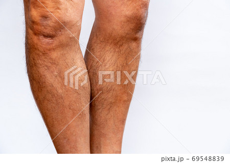 筋トレで筋肉が付いた男性のふくらはぎの写真素材 6954