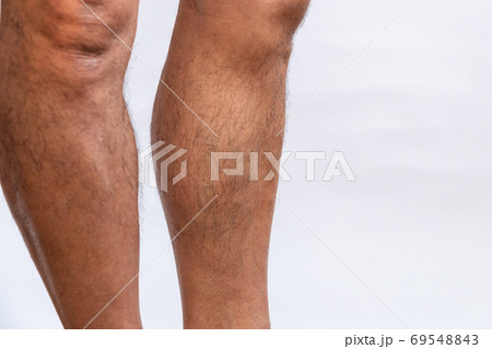 筋トレで筋肉が付いた男性のふくらはぎ 筋トレで筋肉が付いた男性のふくらはぎ 69548843
