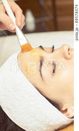 chemic facial and body peel. Cosmetology acne treatment. Young girl 69578374
