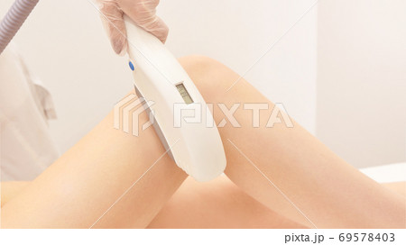 Laser elos medical device. Remove unwanted hair and asteriks. Cosmetology 69578403