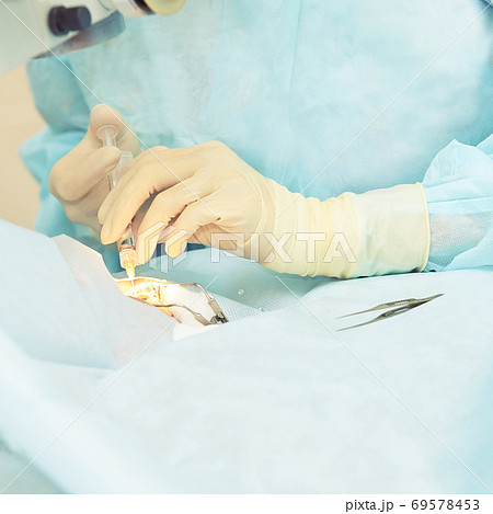 Ophthalmology laser microscope operation. Doctor in clinic. Patient eye treatment. Myopia and cataract removal Ophthalmology laser microscope operation. Doctor in clinic. Patient eye treatment. Myopia and cataract removal 69578453