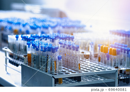 Test tubes with biomaterial in the laboratory 69640081