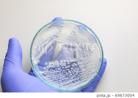 Yeast in petri dish, Microbiology for education in laboratories. Yeast in petri dish, Microbiology for education in laboratories. 69673004