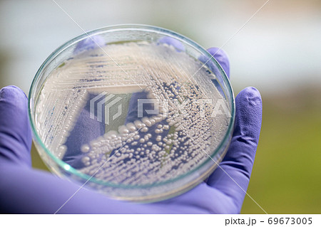 Yeast in petri dish, Microbiology for education in laboratories. Yeast in petri dish, Microbiology for education in laboratories. 69673005