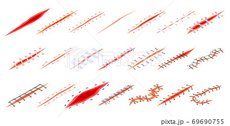 Suture icons set, isometric style 69690755