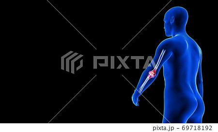 Elbow Pain illustration from rear view - close-up. Blue Human Anatomy Body 3D Scan render - black background 69718192