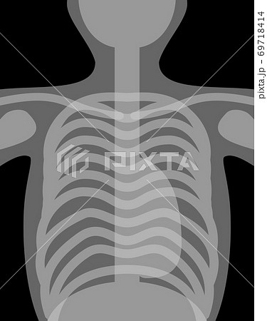 レントゲンのイラストイメージ 69718414
