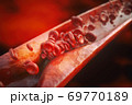 Artheriosclerosis close up 69770189