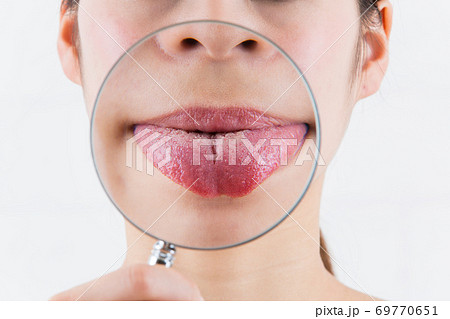 虫めがね・舌クローズアップ. 69770651