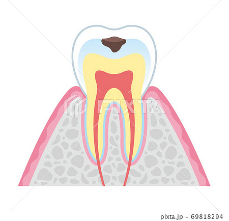 Tooth cross section_4 69818294