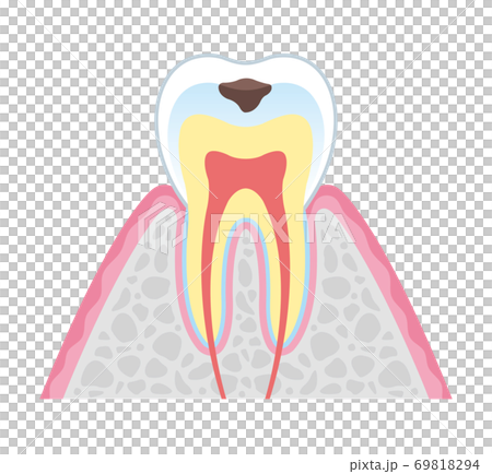 tine, vector, vectors 69818294