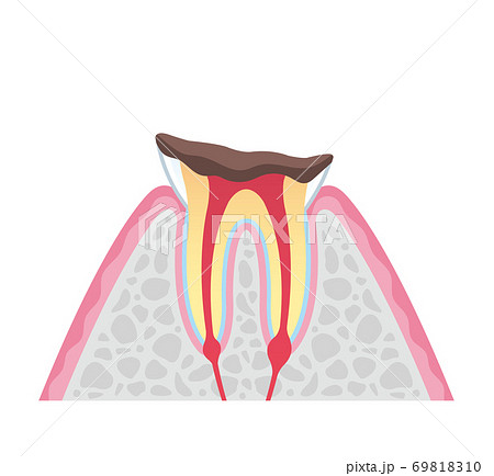 Tooth cross section_7 69818310