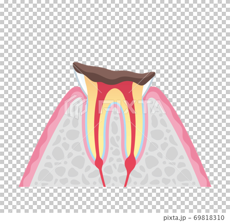 Tooth cross section_7 69818310
