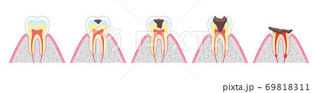 Tooth cross section_8 69818311