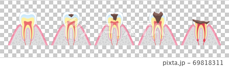 Tooth cross section_8 69818311