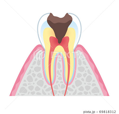 Tooth cross section_6 69818312