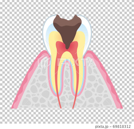 Tooth cross section_6 69818312