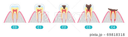 Tooth cross section_9 69818318