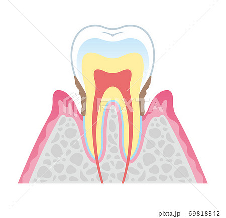 Tooth cross section_15 69818342