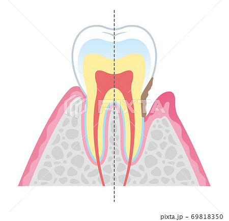 Tooth cross section_14 Tooth cross section_14 69818350
