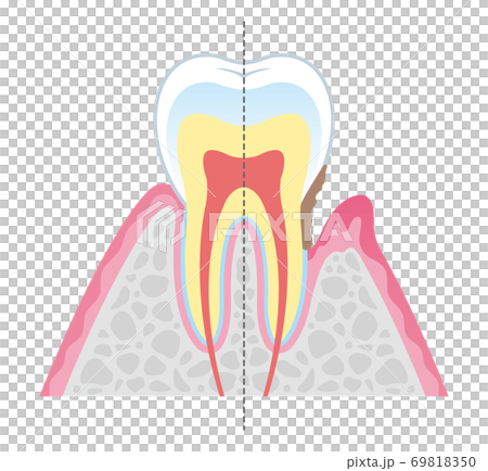 Tooth cross section_14 Tooth cross section_14 69818350