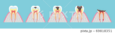 Tooth cross section_10 69818351