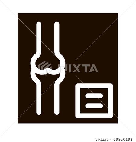 Bone X-ray Image Of Human Joints Orthopedic Vector 69820192