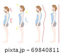 猫背と真っすぐ伸びた姿勢の女性セット 69840811